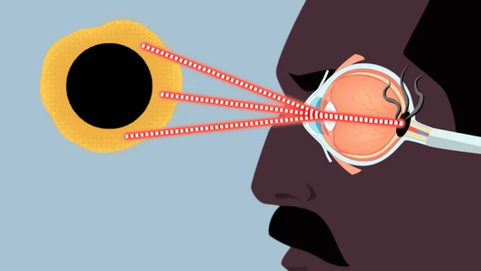 Here's How Solar Eclipses Actually Destroy Your Eyes